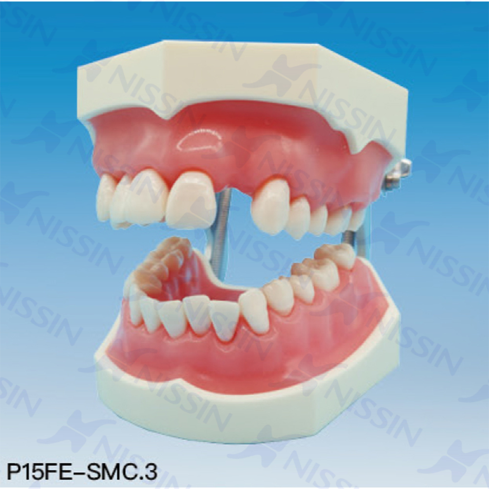 牙周松動牙固定實習模型