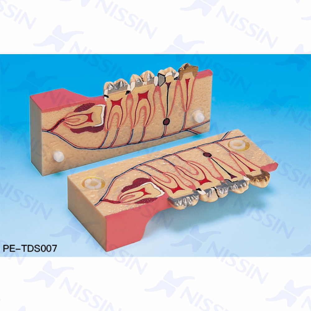 右下后牙分解組織模型